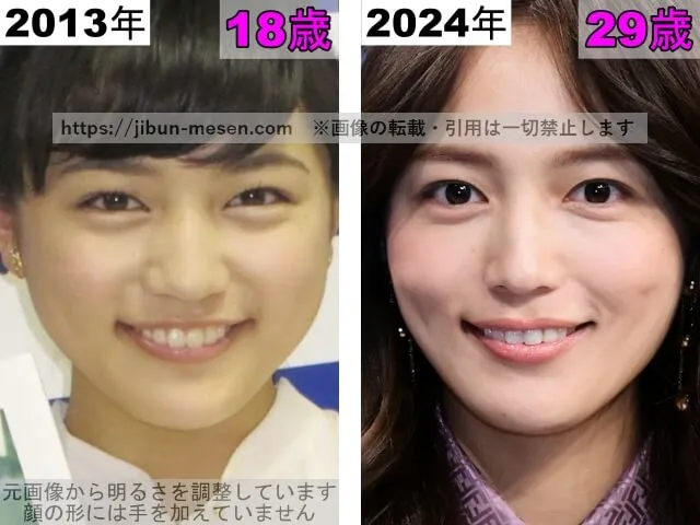 川口春奈の唇の整形検証2013年~2024年