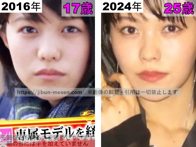 志田彩良の鼻の整形検証2016年～2024年