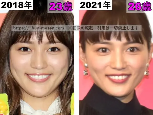 川口春奈の目の整形検証2018年～2021年