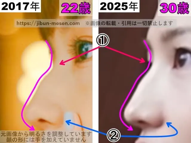 川口春奈の鼻の整形検証2017年~2025年(横顔・拡大)