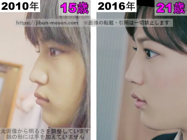 川口春奈の鼻の整形検証2010年~2016年(横顔)