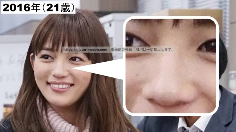 川口春奈の小鼻