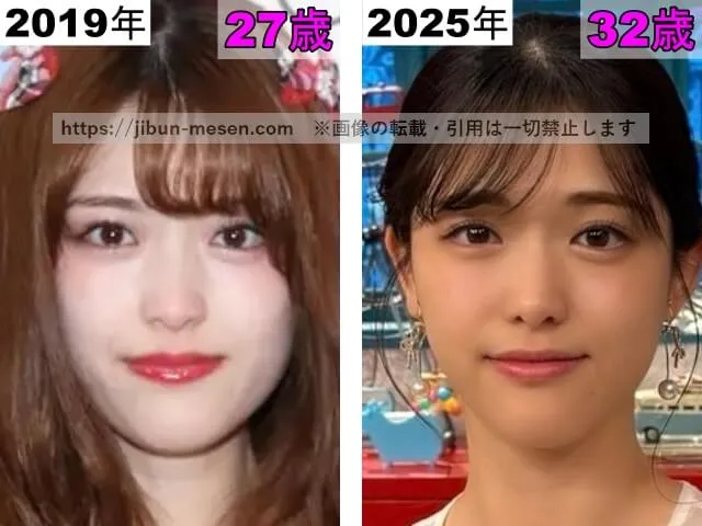 松村沙友理の目の整形検証2019年～2025年