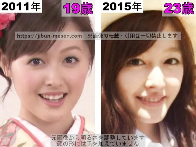 久住小春の鼻の整形検証2011年～2015年