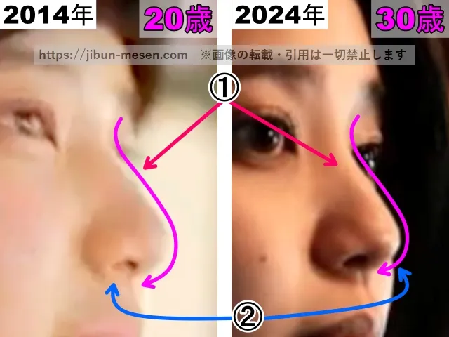 山崎紘菜の鼻の整形検証2014年～2024年（横顔・拡大）