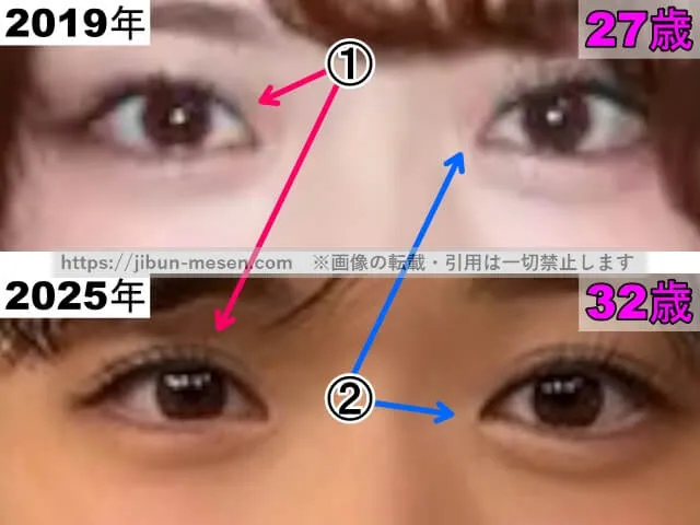 松村沙友理の目の整形検証2019年～2025年（拡大）