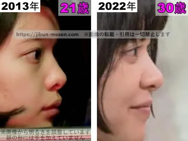 岸井ゆきのの鼻の整形検証2013年〜2022年(横顔)