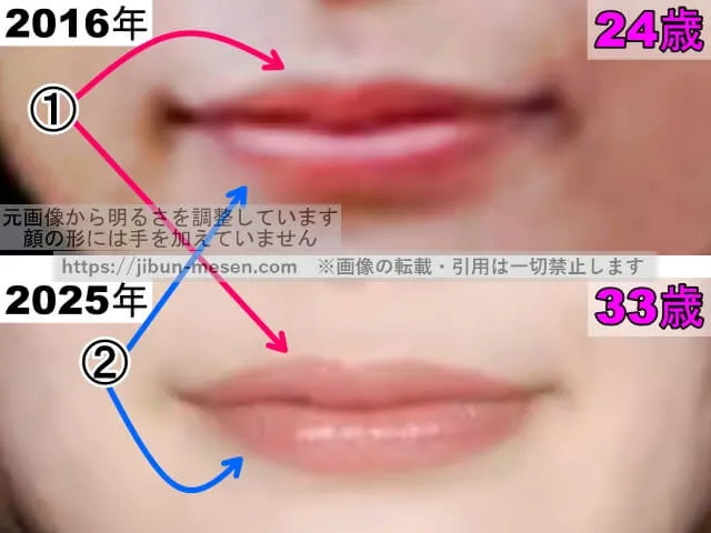 岸井ゆきのの唇の整形検証2016年〜2025年(拡大)