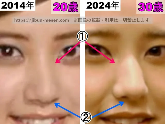 山崎紘菜の鼻の整形検証2014年～2024年（拡大）