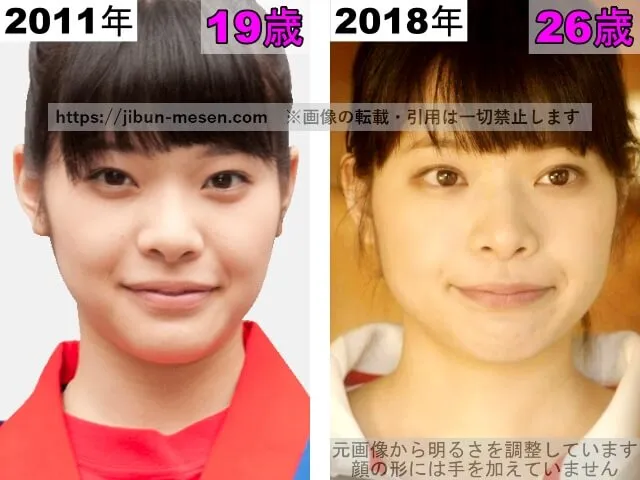 岸井ゆきのの目の整形検証2011年〜2018年