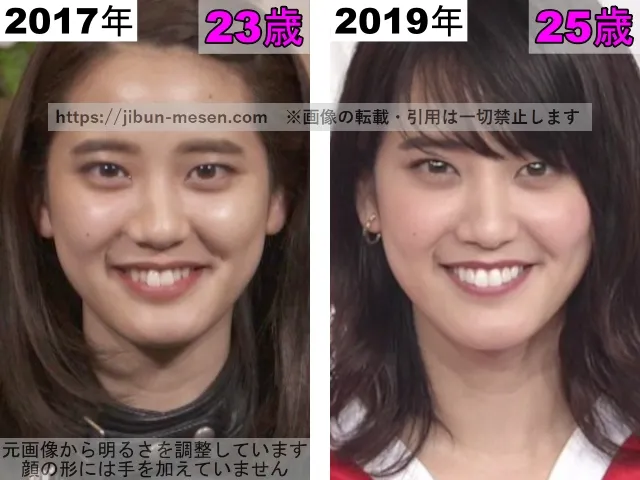 山崎紘菜の歯並びの変化2017年～2019年