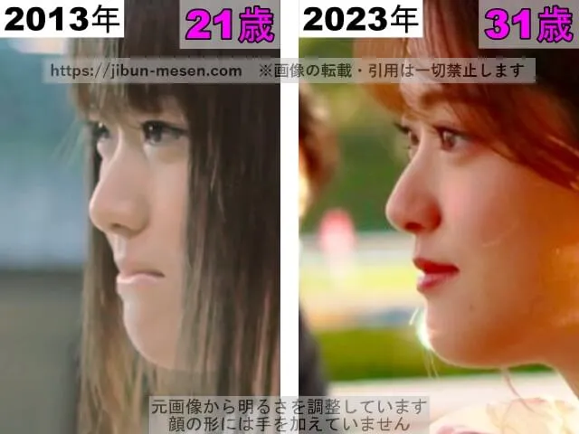 松村沙友理の鼻の整形検証2013年～2023年（横顔）