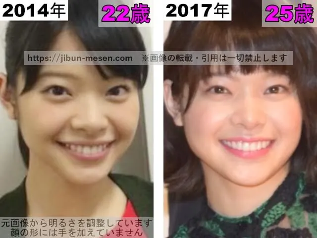 岸井ゆきのの唇の整形検証2014年〜2017年