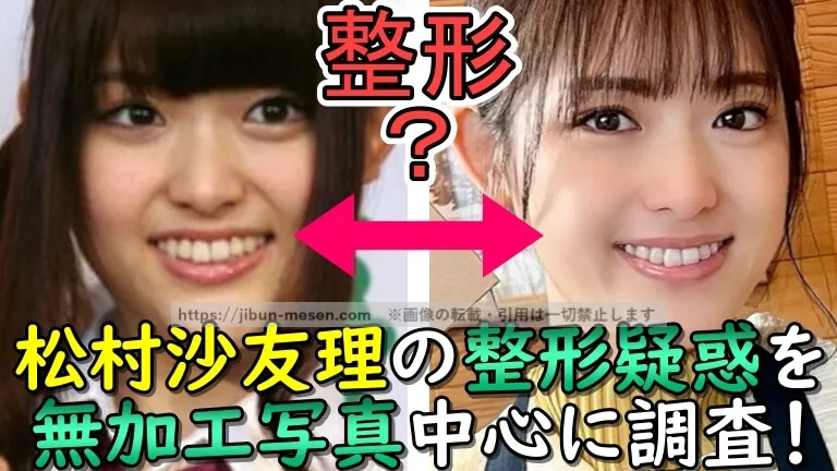松村沙友里の整形疑惑を無加工写真中心に調査！