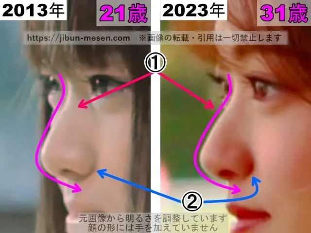 松村沙友理の鼻の整形検証2013年～2023年（横顔・拡大）