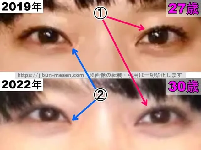 岸井ゆきのの目の整形検証2019年〜2022年(拡大)