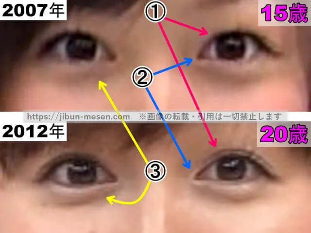 久住小春の目の整形検証2007年～2012年（拡大）