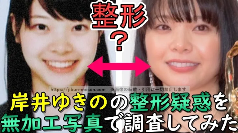 整形？岸井ゆきのの整形疑惑を無加工写真で調査してみた