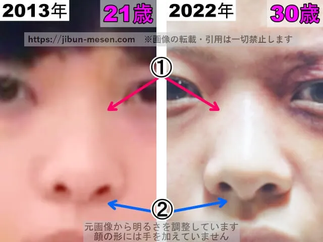 岸井ゆきのの鼻の整形検証2013年〜2022年(拡大)