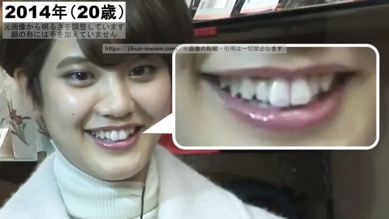 山崎紘菜の歯並び