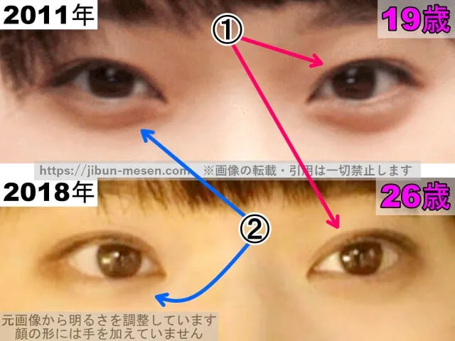 岸井ゆきのの目の整形検証2011年〜2018年(拡大)
