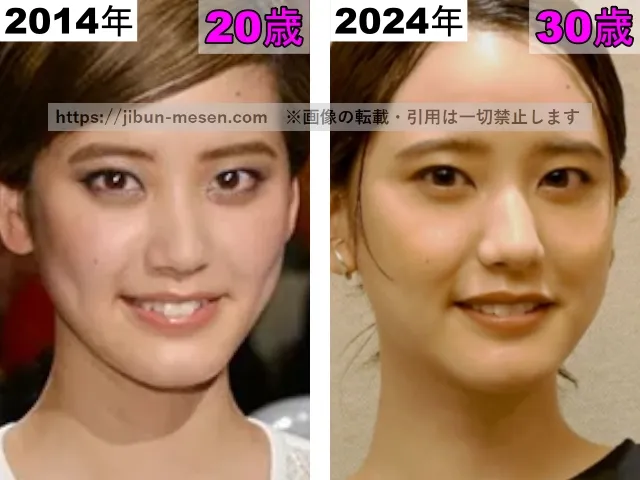 山崎紘菜の鼻の整形検証2014年～2024年