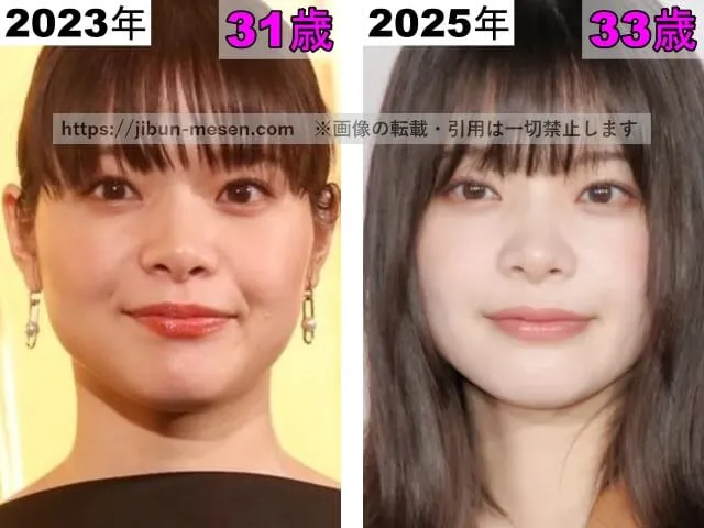 岸井ゆきのの目の整形検証2023年〜2025年
