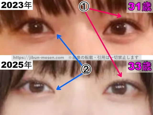 岸井ゆきのの目の整形検証2023年〜2025年(拡大)