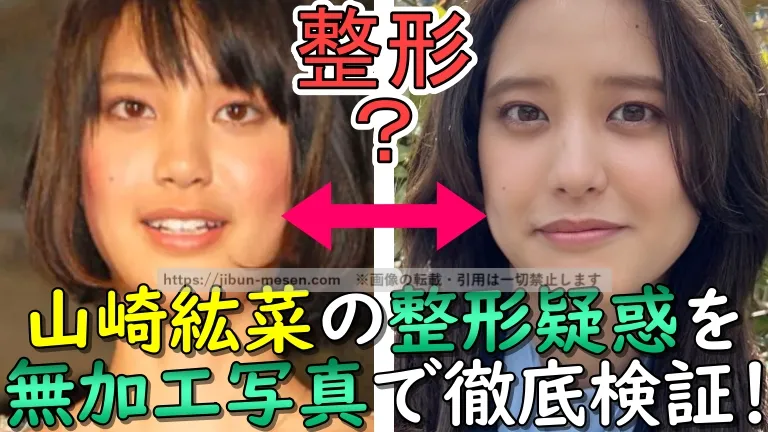 整形？山崎紘菜の整形疑惑を無加工写真で徹底検証！