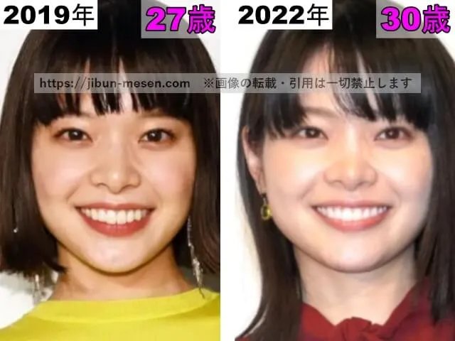 岸井ゆきのの目の整形検証2019年〜2022年