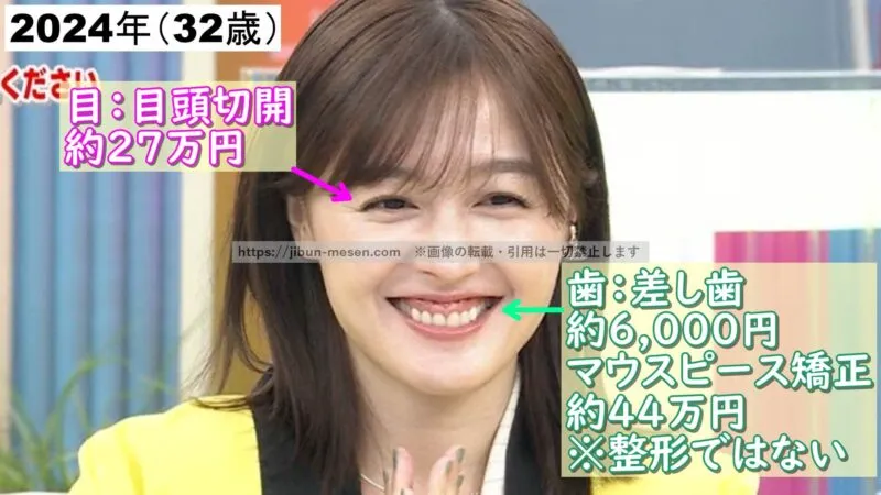 久住小春が整形した箇所とその費用