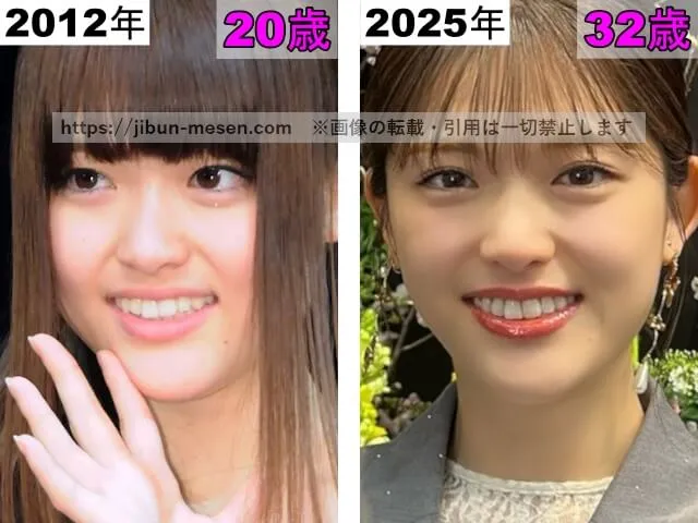 松村沙友理の唇の整形検証2012年～2025年