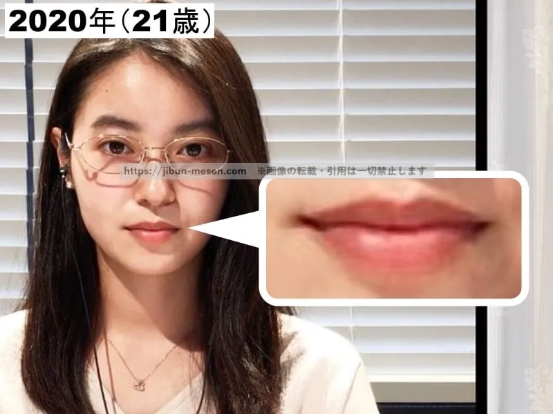 田辺桃子の唇のボリューム感