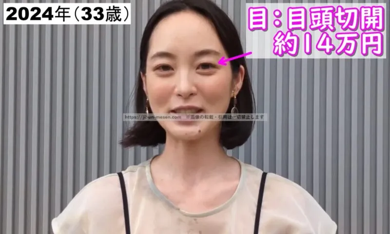 朝倉あきが整形した箇所とのその費用