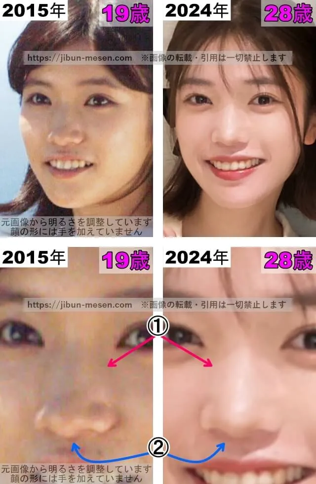 美山加恋の鼻の整形検証2015年〜2024年