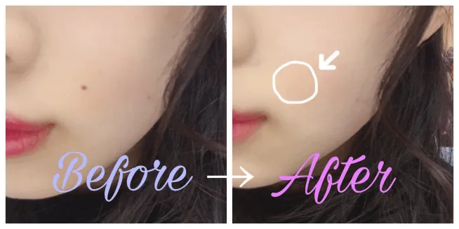 コンシーラーでホクロを隠すメイクのビフォーアフター（ノンデプルームHPより引用）