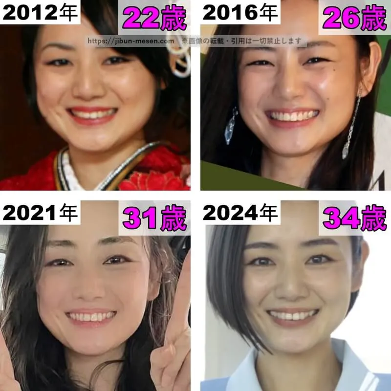 片山萌美の鼻の整形検証2012年〜2024年