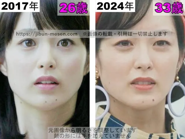 朝倉あきの唇の整形検証2017年〜2024年