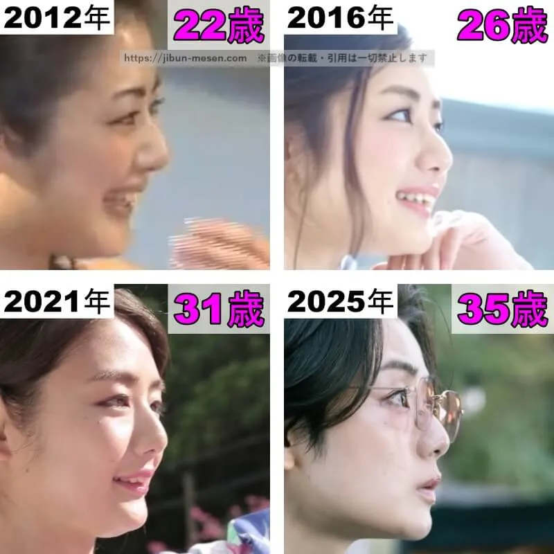 片山萌美の鼻の整形検証2012年〜2025年（横顔）