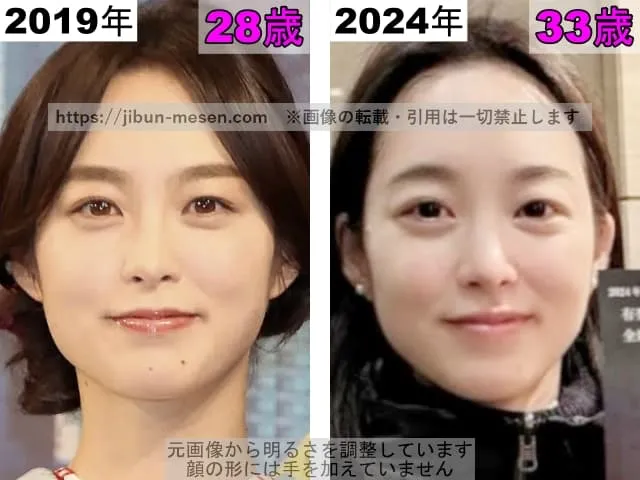 朝倉あきの鼻の整形検証2019年〜2024年