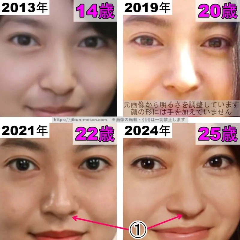 田辺桃子の鼻の整形検証2013年〜2024年（拡大）