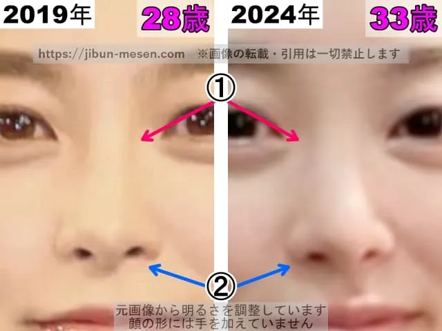 朝倉あきの鼻の整形検証2019年〜2024年（拡大）