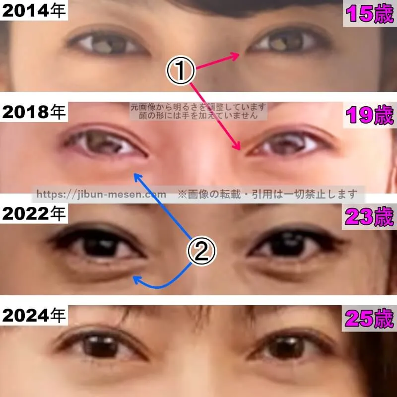 田辺桃子の目の整形検証2014年〜2024年(拡大)