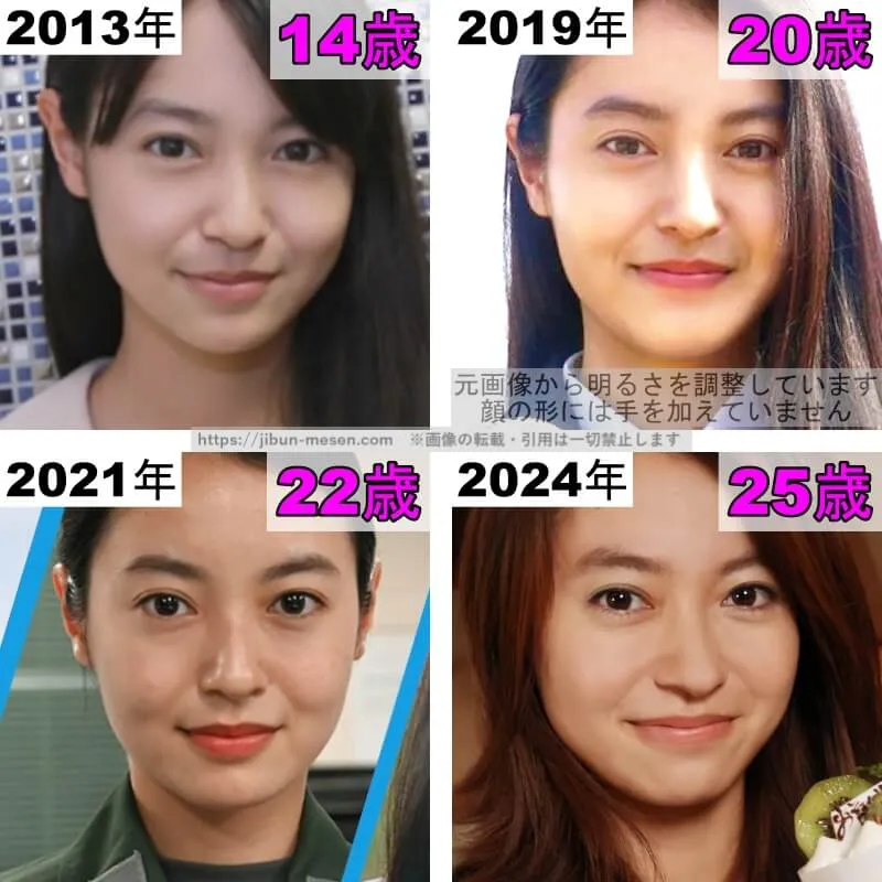 田辺桃子の鼻の整形検証2013年〜2024年