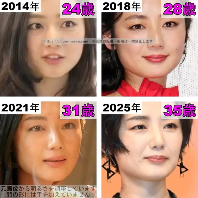 片山萌美の目の整形検証2014年〜2025年