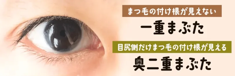 奥二重の例（出典：HAABクリニック公式サイト）