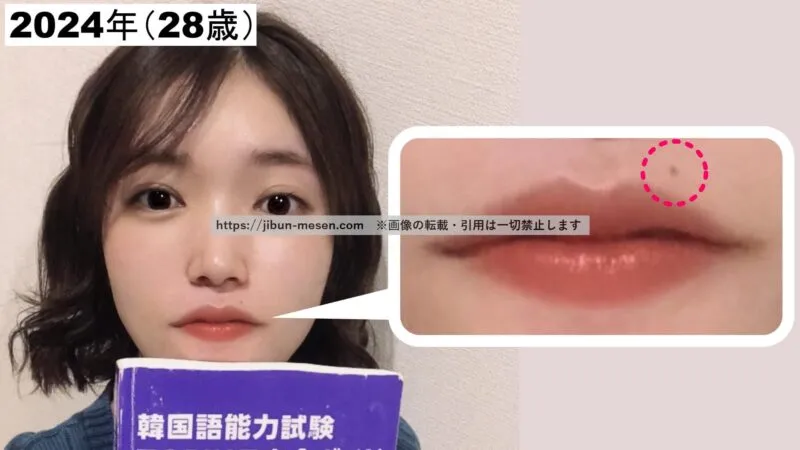 美山加恋のホクロ