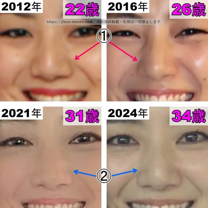 片山萌美の鼻の整形検証2012年〜2024年（拡大）