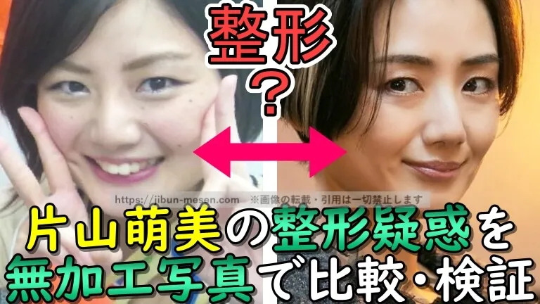 整形？片山萌美の整形疑惑を無加工写真で比較・検証
