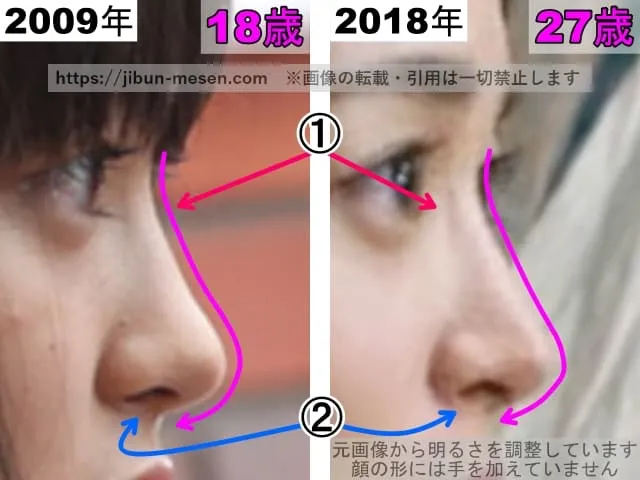 朝倉あきの鼻の整形検証2009年〜2018年（横顔・拡大）